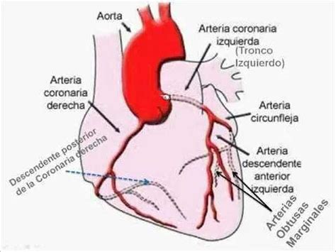 Esquema Arterias Coronarias - Cardiacos.net