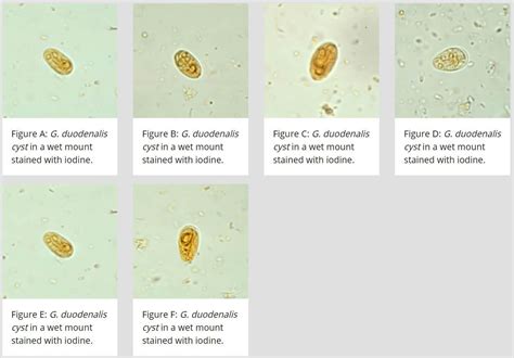 Giardia Lamblia's Instagram, Twitter & Facebook on IDCrawl