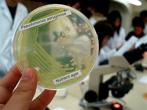 Pseudomonas aeruginosa -Gram Stain, Culture Characteristics, Infection