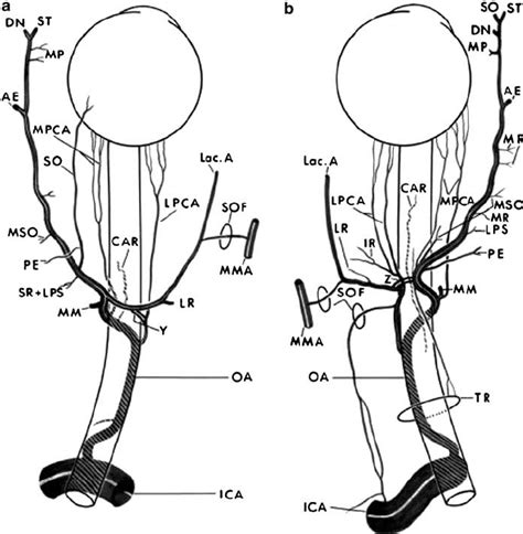 Origin, course, and branches of the ophthalmic artery in two adult ...