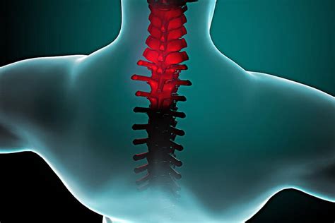 Stiff Neck Causes and Treatments | AZ Pain Management Doctors