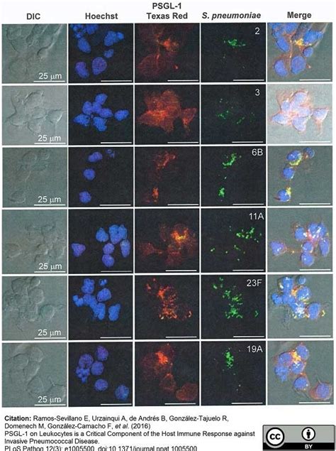 Anti Mouse IgG Antibody - Purified 1mg | Bio-Rad