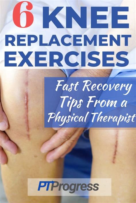 Knee Replacement Exercises To Do After Surgery