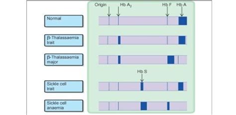 Hemoglobin electrophoresis [49] | Download Scientific Diagram