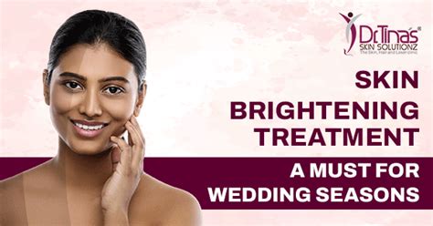 Skin Brightening Treatment- A Must for Wedding Seasons - Skin Solutionz