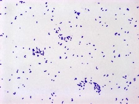 Gram-Positive Coccobacilli - Microbiology learning: The "why"ology of ...