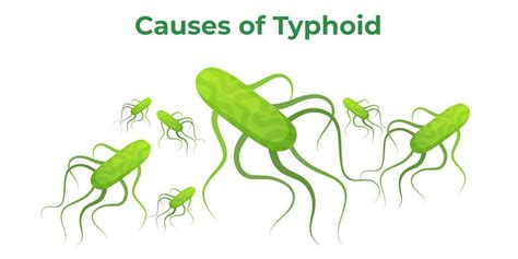 Typhoid Fever - Symptoms, Causes, Prevention and Treatment