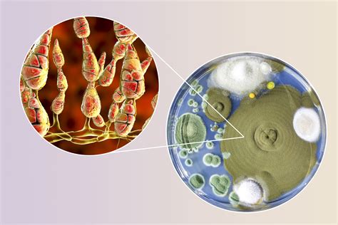 Mold Alternaria alternata, illustration and photo of colony on nutrient ...