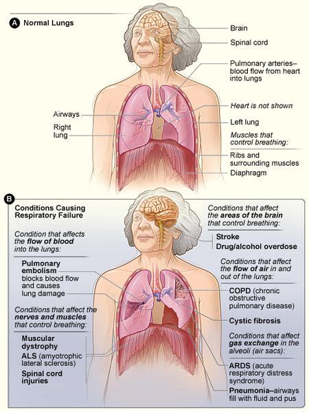 Oxygen Deficiency in Surrounding Tissues Is Called