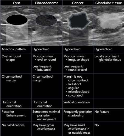 The Radiology Assistant : Ultrasound of the Breast