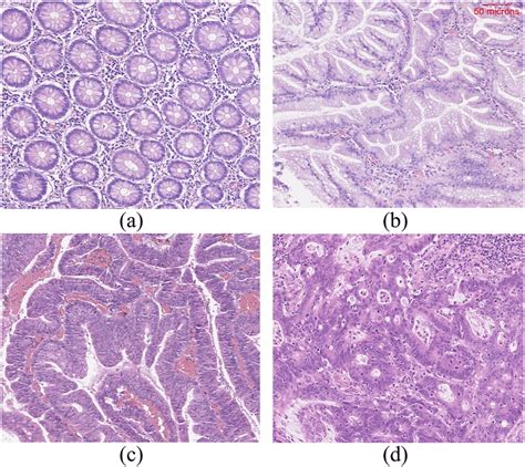 Example images of haematoxylin and eosin stained normal tissue and ...