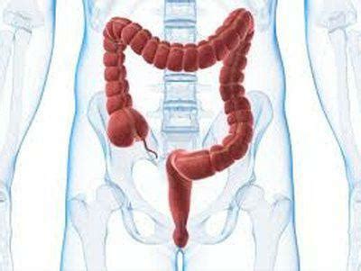 Inflammation of the cecum: symptoms, treatment