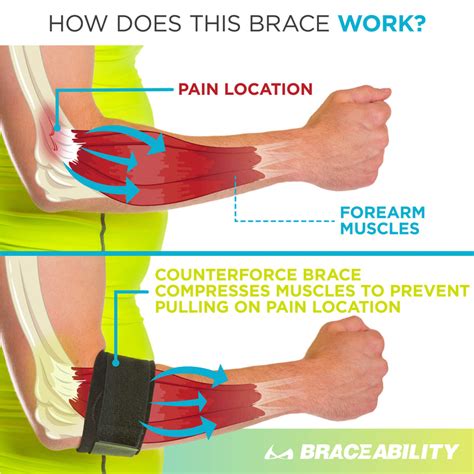 Tendonitis Counterforce Brace | Tennis & Golfers Elbow Support Strap