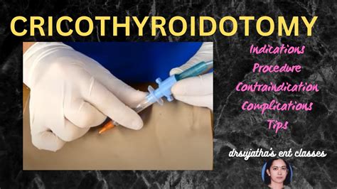 205.cricothyroidotomy #cricothyrotomy procedure #airway #emergency # ...