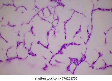 Bacteria On Slide Under Microscope Constitute Stock Photo 796201756 ...