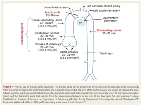 normal aortic root size | Dr.S.Venkatesan MD