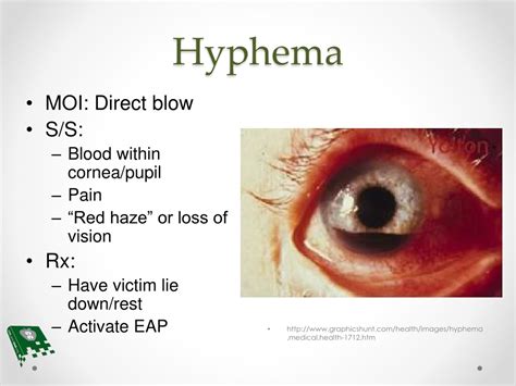 PPT - Eye Injuries PowerPoint Presentation, free download - ID:9177236