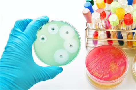 Experts have mapped levels of antimicrobial resistance worldwide ...