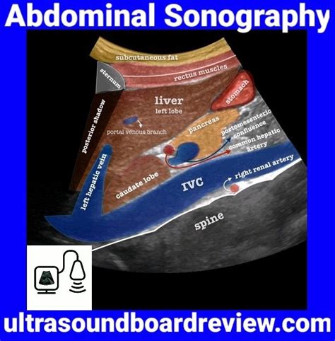 Abdominal Sonography | Diagnostic medical sonography, Diagnostic ...