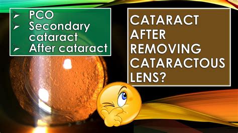 Posterior capsular opacification (PCO) and Nd YAG posterior capsulotomy ...