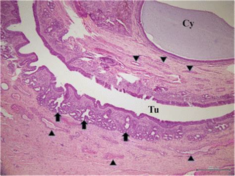 Nasal Turbinate Histology