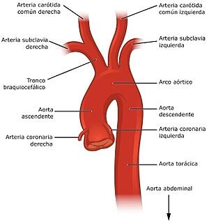 ANATOMÍA - DUCTUS ARTERIOSO PERSISTENTE