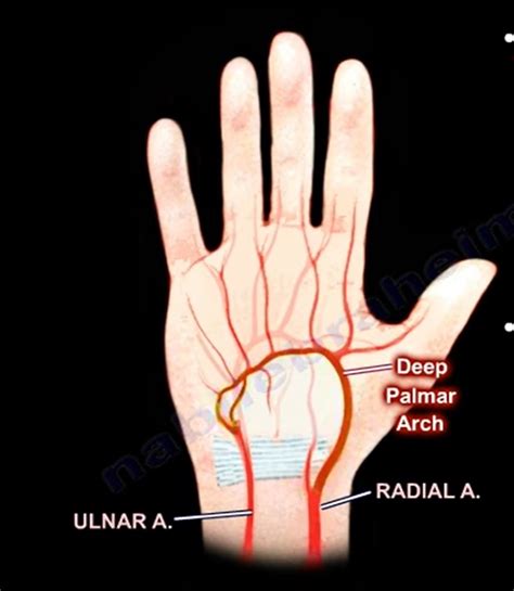 Anatomy Of The Ulnar artery — OrthopaedicPrinciples.com