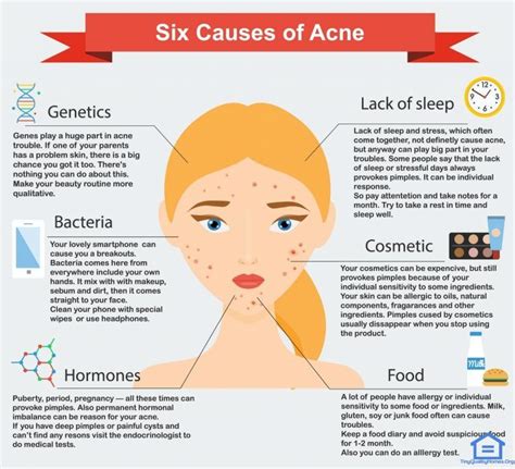 41 Health Benefits Of Almonds | Acne causes, Acne, Acne treatment