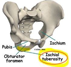 ischial tuberosity Anatomy, Location, Pain, Treatment, Causes. Ischial ...