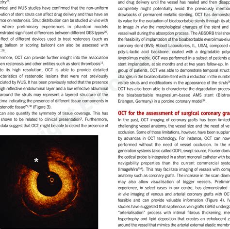 Stent restenosis. Stent restenosis 4 months after implantation of a ...