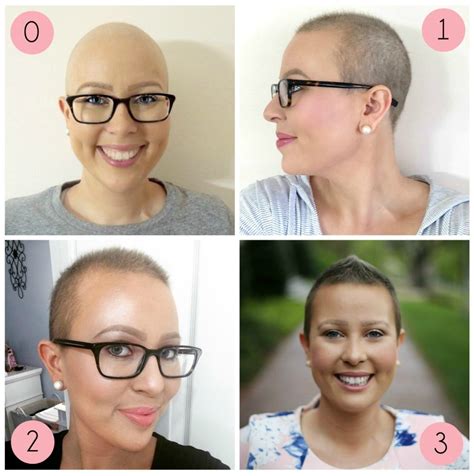 Hair Growth & Styling Tips for Short Hair After Chemo