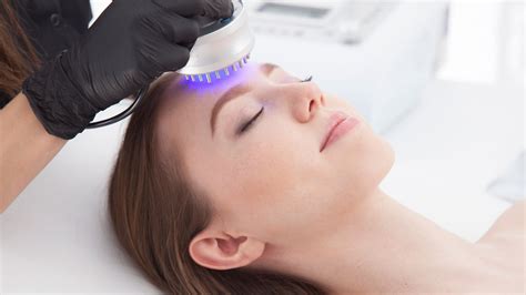 Photodynamic Therapy (PDT) - Laser Aesthetics