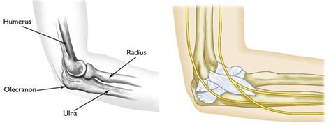 Elbow (Olecranon) Fractures - OrthoInfo - AAOS