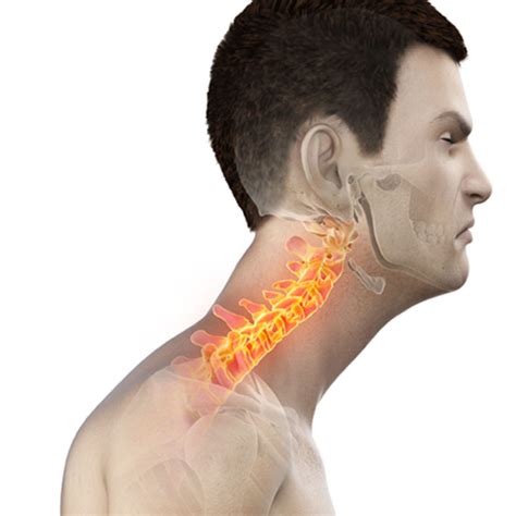 The Destructive Impact of Abnormal Posture