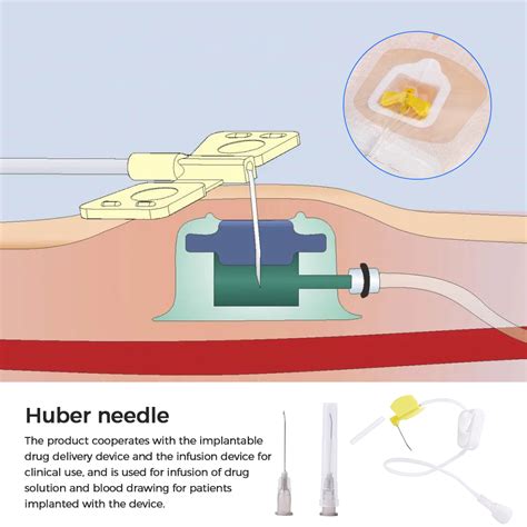 Huber Needle