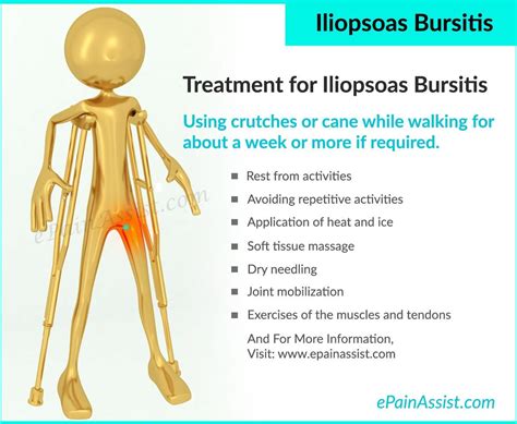 Iliopsoas Bursitis or Iliopectineal Bursitis | Hip bursitis exercises ...