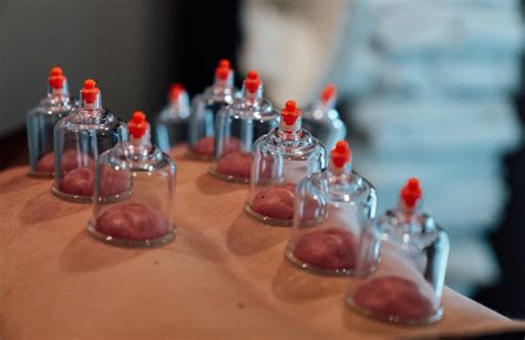 The Benefits of Cupping | Depth Training & Physiotherapy