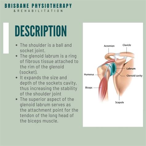 What is a Shoulder Glenoid Labrum Injury? - Brisbane Physiotherapy