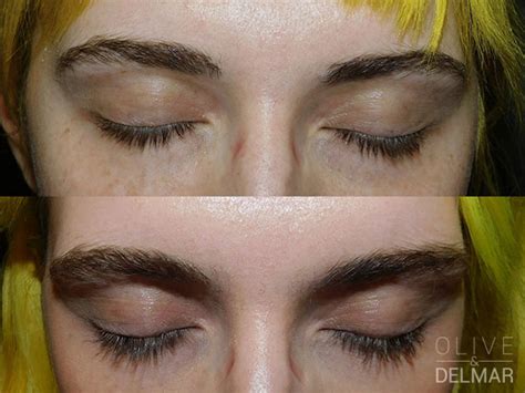 neuLASH and neuBROW Before and After | LovelySkin