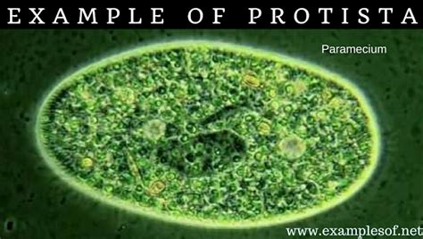 20 Examples of Protozoa (Protista) | Kingdom Protista