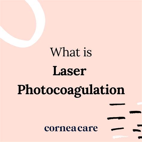 Laser Photocoagulation Definition - CorneaCare