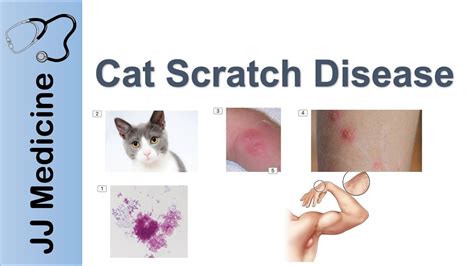 Can Rabies Spread Through Cat Scratch - Aleah-has-Mathews