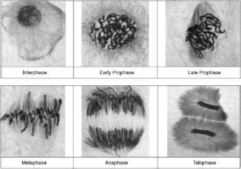 Mitosis Under Microscope Labeled