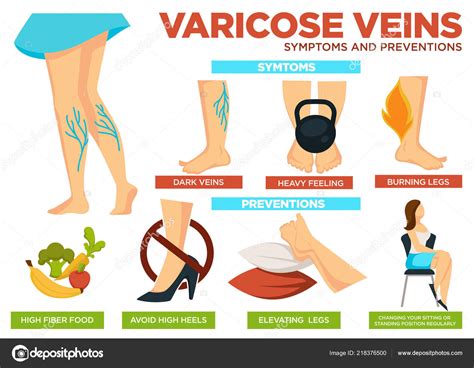 Varicose Veins Symptoms Preventions Poster Info Vector Heavy Feeling ...