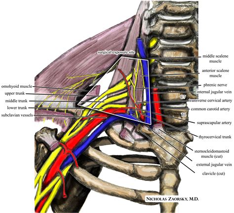 File:Wikipedia medical illustration thoracic outlet syndrome brachial ...