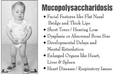 Mucopolysaccharidosis | Inborn Metabolic Diseases - Types, Symptoms ...