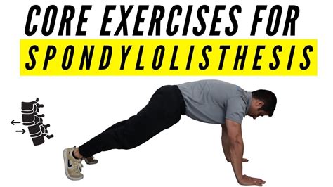 Core exercises for Spondylolisthesis - YouTube