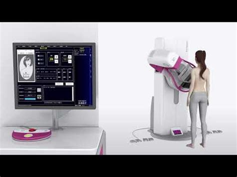 Sinomdt Tomosynthesis 3D Digital Mammography Machine Introduction - YouTube