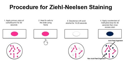 Ziehl-Neelsen Staining- Principle and Procedure with Results