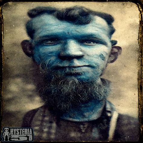 The Fugate Family: The Blue People of Kentucky | 299 | Listen Notes